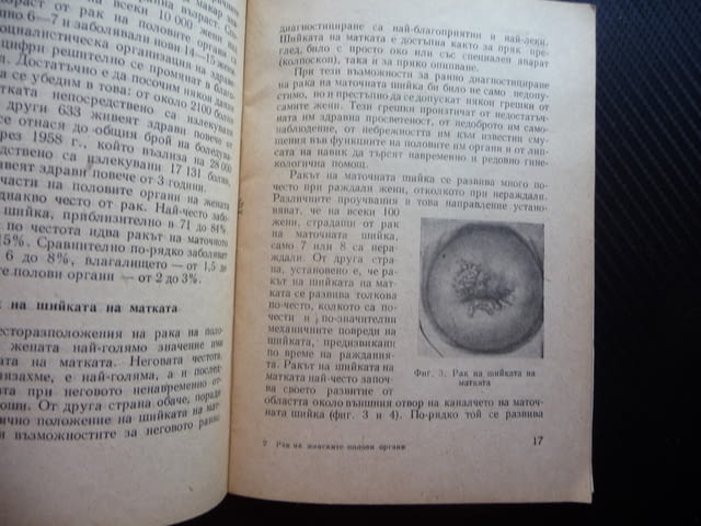 Рак на женските полови органи Тодор Ат. Вълков заболявания болести - снимка 2