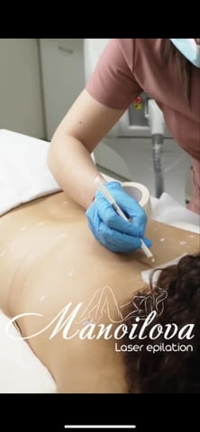 Лазерна епилация на достъпни цени - град София | Други - снимка 2